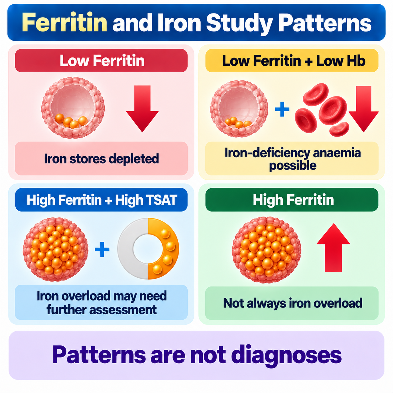 Common ferritin and iron study patterns — low ferritin, low ferritin with low haemoglobin, high ferritin with high TSAT, high ferritin alone