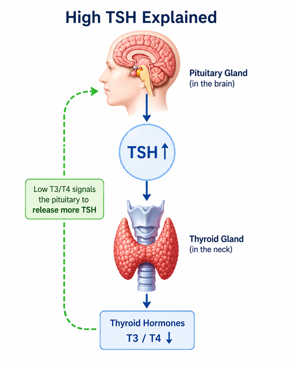 High TSH explained — diagram showing pituitary response to low thyroid hormone