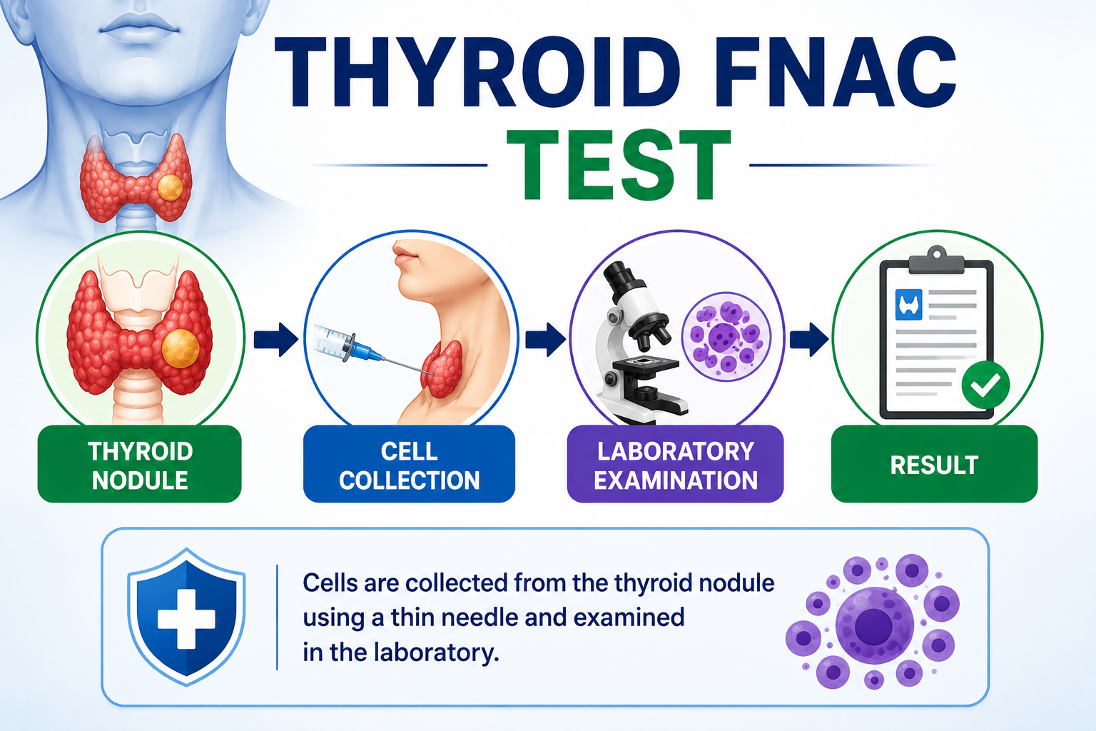 Thyroid FNAC Test — Thin needle collects cells from a thyroid nodule for laboratory examination