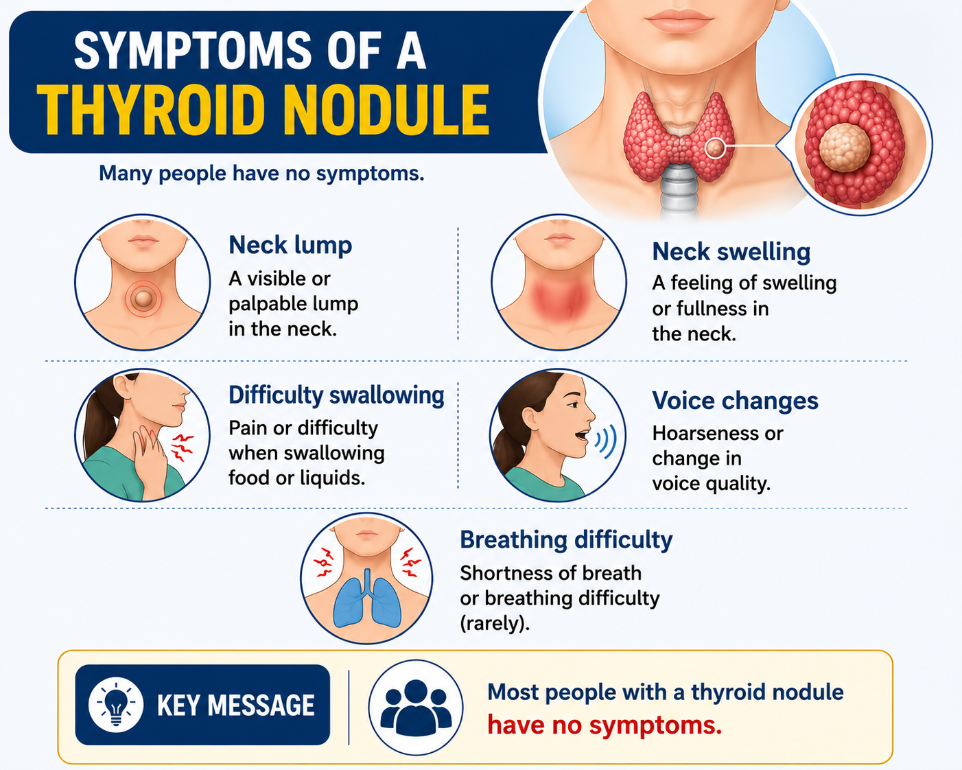 Thyroid Nodule Symptoms — Neck lump, neck fullness, difficulty swallowing, voice change